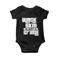 Black Skin Is Not A Crime Baby Onesie