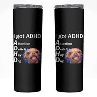 Funny ADHD Dog Meme Skinny Tumbler Attention Deficit Hey Dog Humor Lovers - Wonder Print Shop