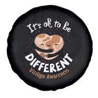 Vitiligo Awareness Spare Tire Cover Its Ok To Be Different