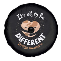 Vitiligo Awareness Spare Tire Cover Its Ok To Be Different