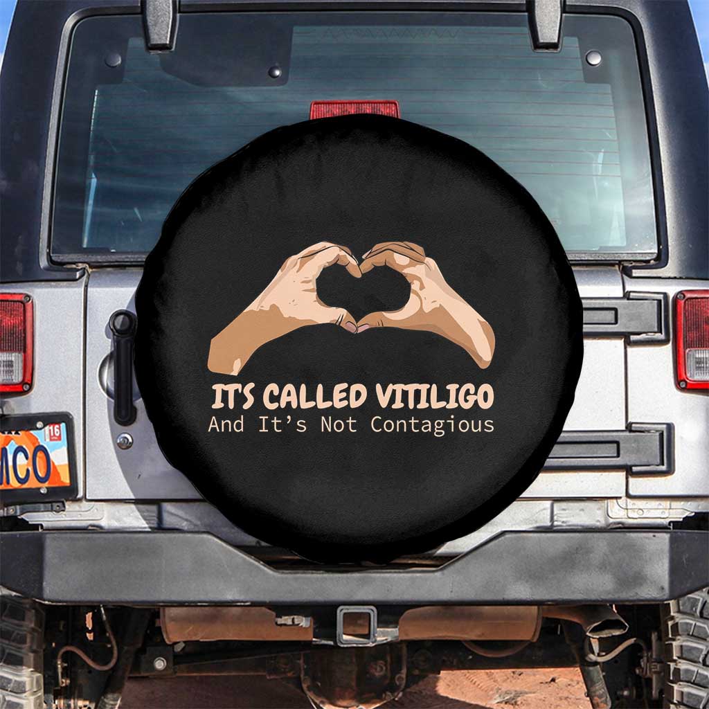 Vitiligo Awareness Spare Tire Cover It's Called Vitiligo And It's Not Contagious