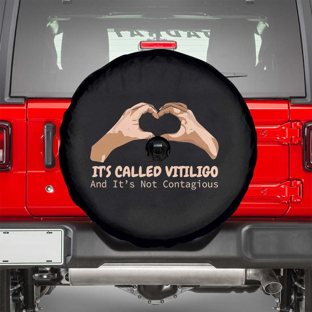 Vitiligo Awareness Spare Tire Cover It's Called Vitiligo And It's Not Contagious