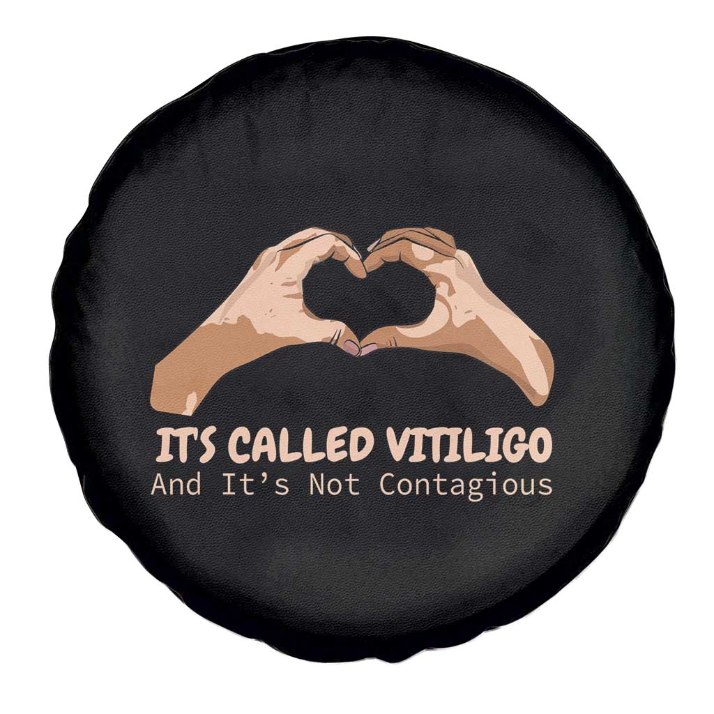 Vitiligo Awareness Spare Tire Cover It's Called Vitiligo And It's Not Contagious