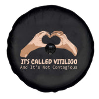 Vitiligo Awareness Spare Tire Cover It's Called Vitiligo And It's Not Contagious