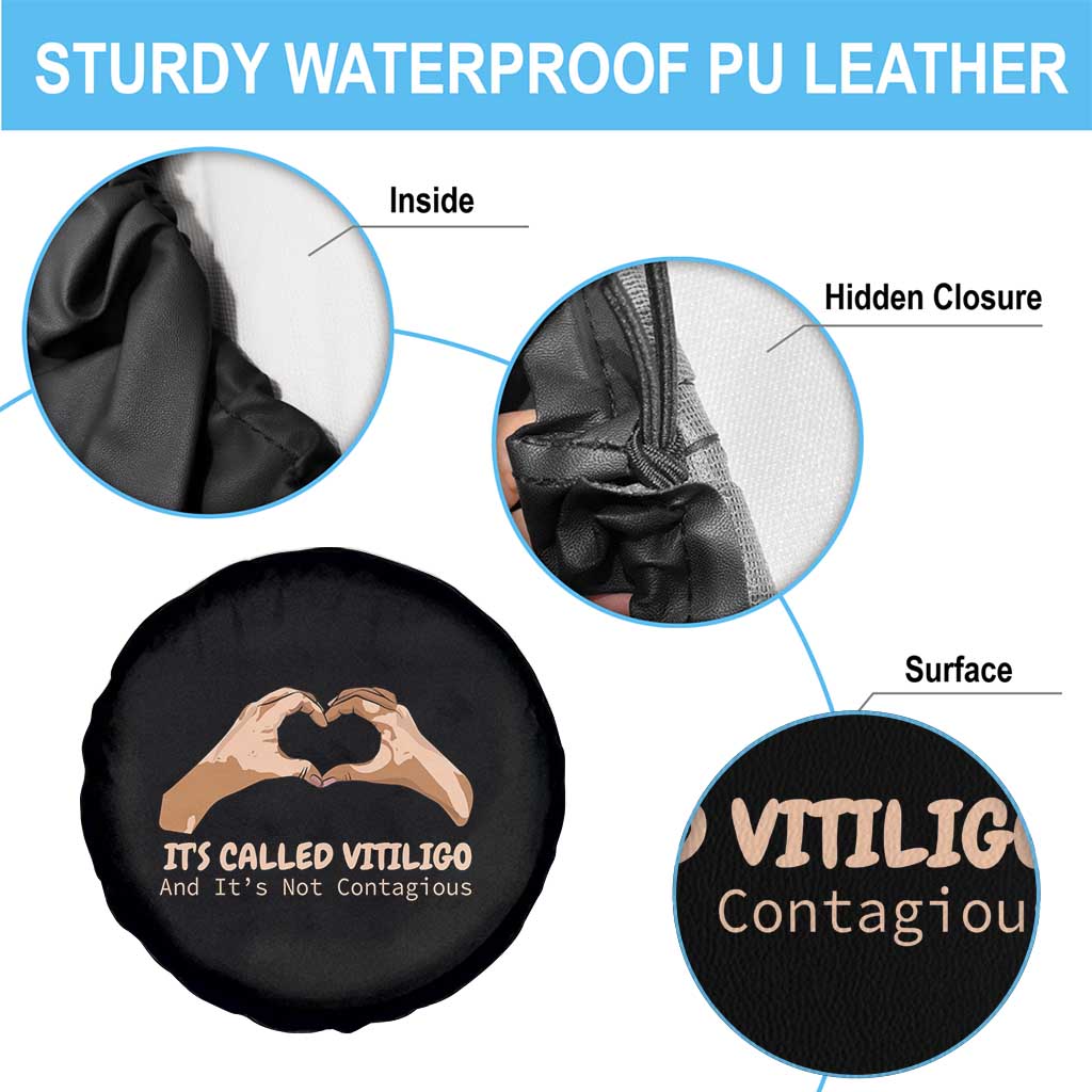 Vitiligo Awareness Spare Tire Cover It's Called Vitiligo And It's Not Contagious