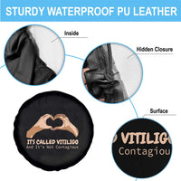 Vitiligo Awareness Spare Tire Cover It's Called Vitiligo And It's Not Contagious