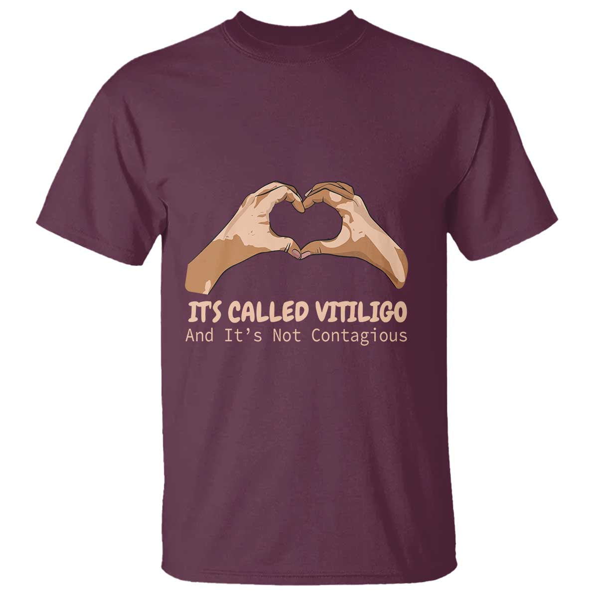 Vitiligo Awareness T Shirt It's Called Vitiligo And It's Not Contagious - Wonder Print Shop