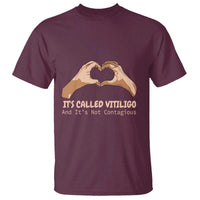 Vitiligo Awareness T Shirt It's Called Vitiligo And It's Not Contagious - Wonder Print Shop