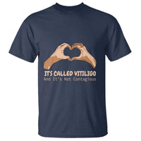 Vitiligo Awareness T Shirt It's Called Vitiligo And It's Not Contagious - Wonder Print Shop