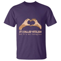 Vitiligo Awareness T Shirt It's Called Vitiligo And It's Not Contagious - Wonder Print Shop
