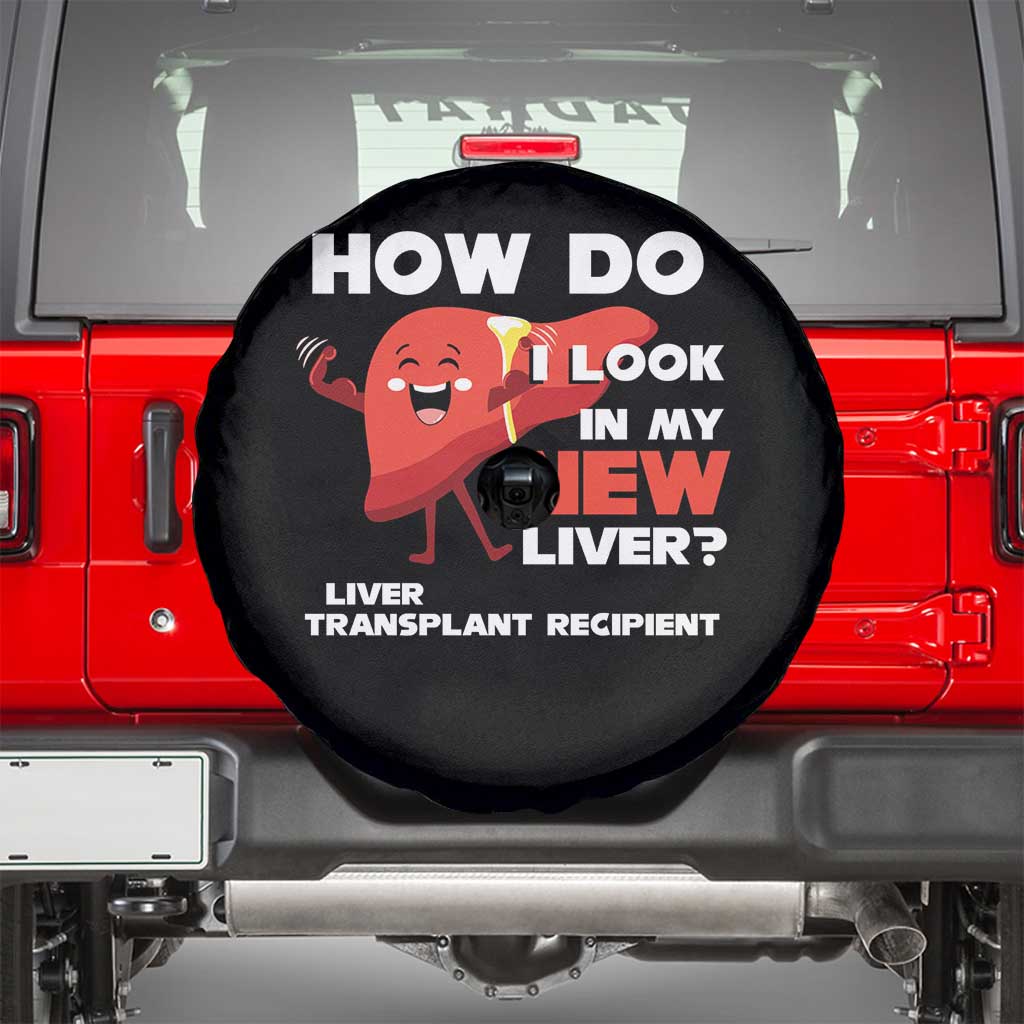 Liver Transplant Recipient Spare Tire Cover How Do I Look in My New Liver