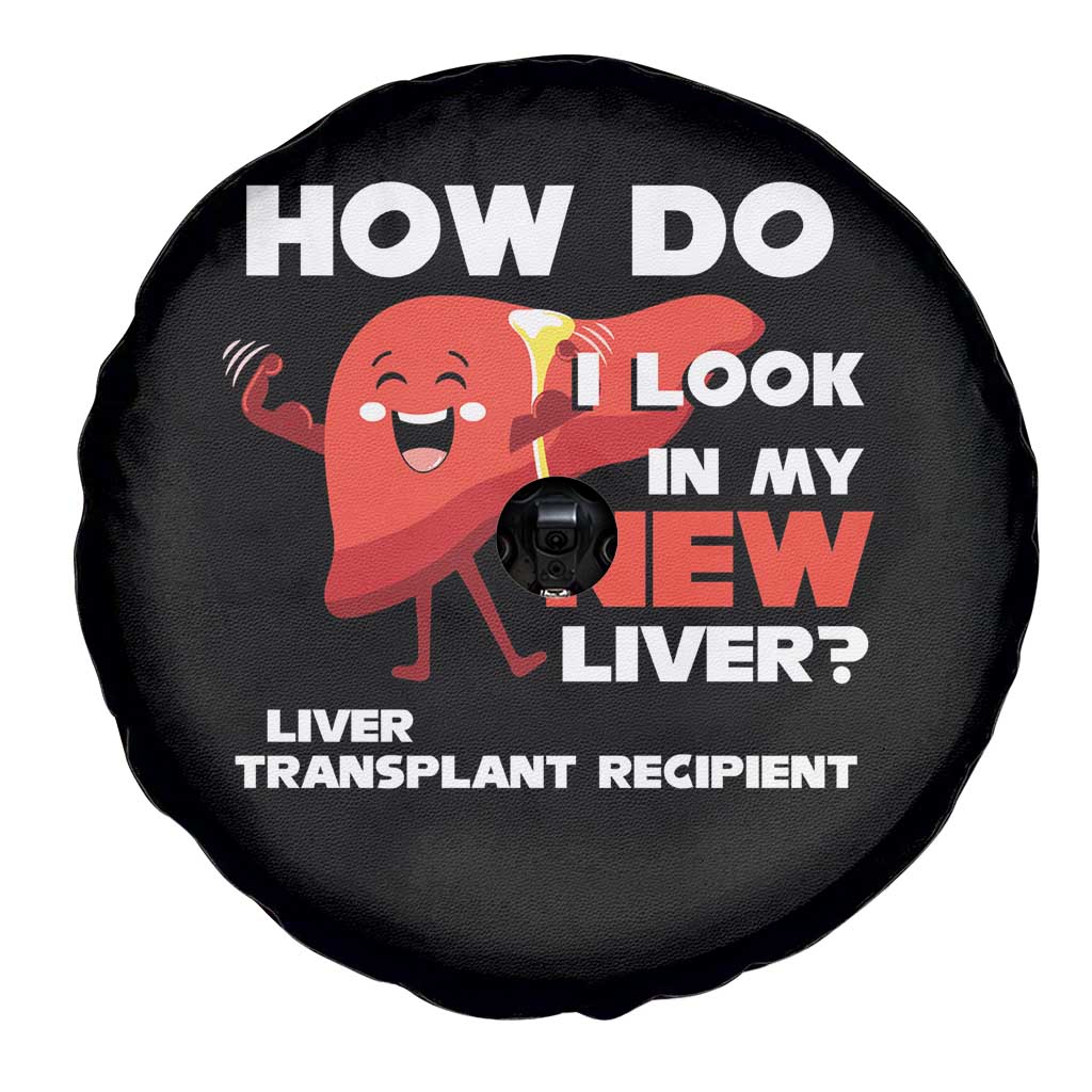 Liver Transplant Recipient Spare Tire Cover How Do I Look in My New Liver