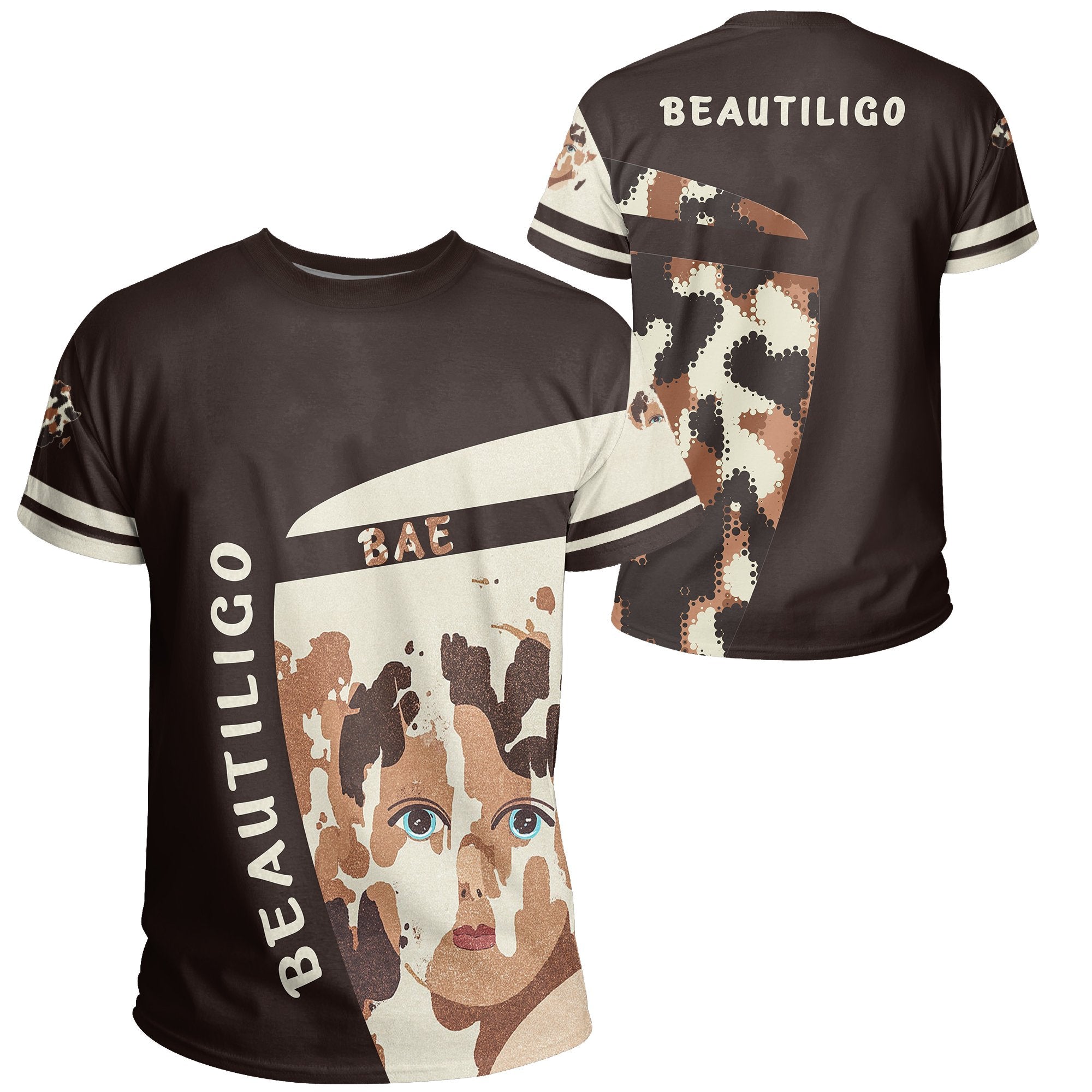 wonder-print-shop-t-shirt-vitiligo-cloth-beautiligo-bae-tee
